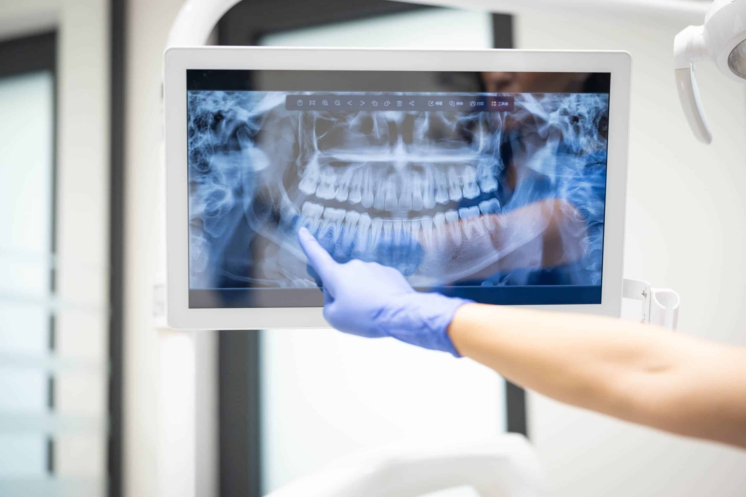 A,Close-up,Image,Capturing,A,Dentist's,Gloved,Hand,Pointing,To
